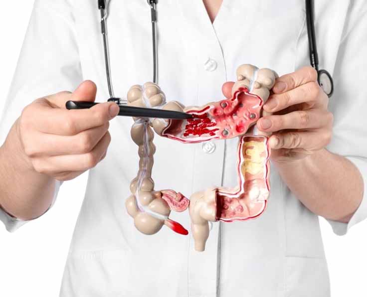 gastroenterology