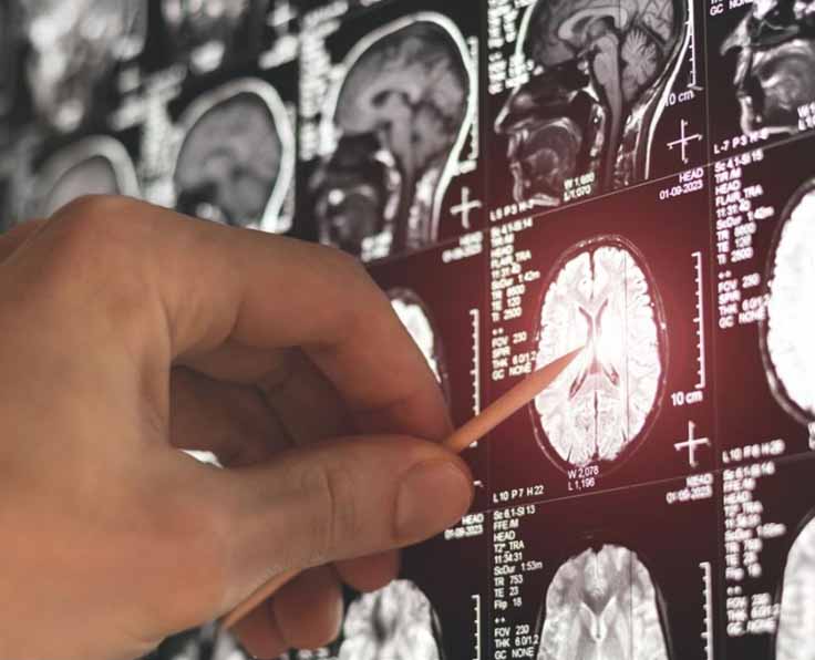 neurology-neurosurgery